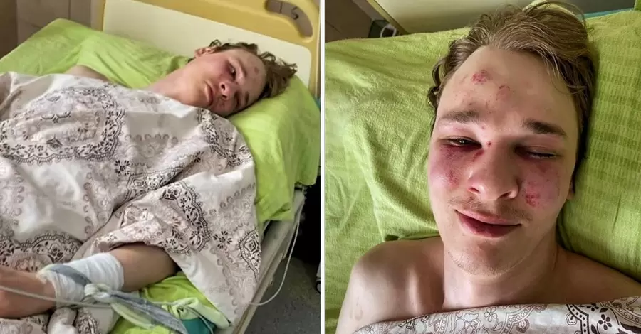 У Закарпатському обласному ТЦК спростували побиття хлопця, який здійснив спробу суїциду