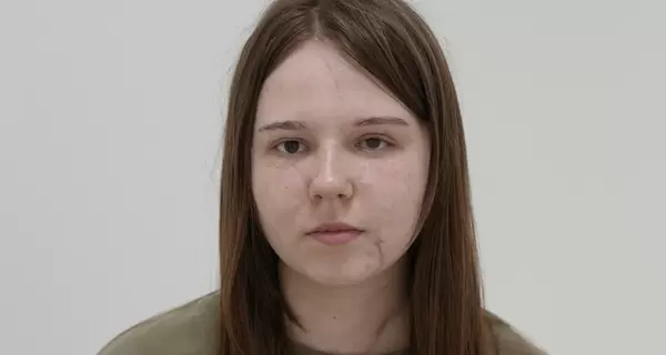 Во Львове восстанавливают лицо 20-летней девушке, пострадавшей в результате удара по Днепру