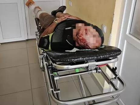 Чтобы незаконно попасть в Польшу, мужчина спрыгнул с поезда, но сломал ногу и разбил голову