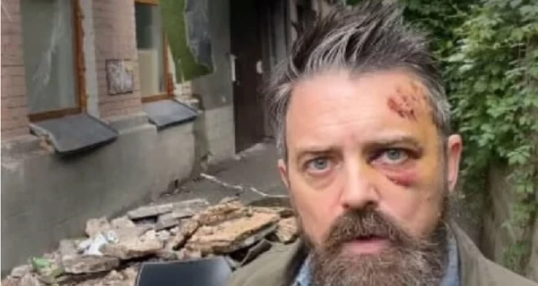 В Киеве на американского режиссера Кристофера Уолтерса упал балкон