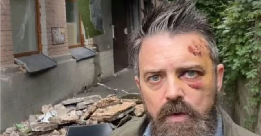 У Києві на американського режисера Крістофера Волтерса впав балкон