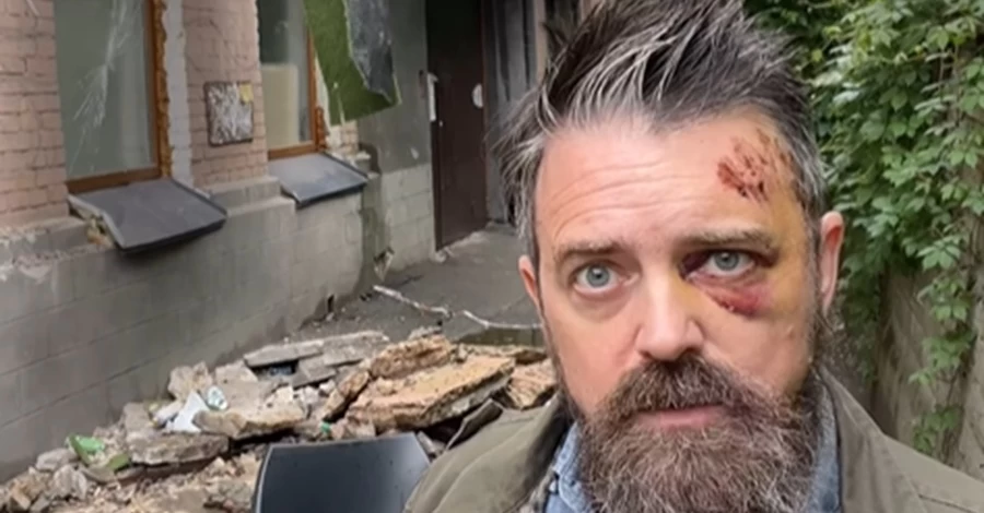 Пострадавший при обвале балкона Уолтерс призвал проверить все фасады в Киеве