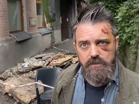Пострадавший при обвале балкона Уолтерс призвал проверить все фасады в Киеве