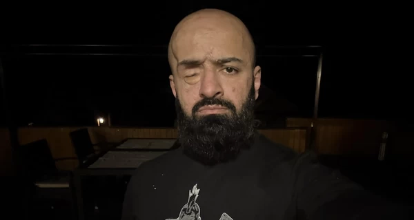 Маси Найем пожаловался, что не смог пройти идентификацию в Монобанке, так как система просила моргнуть