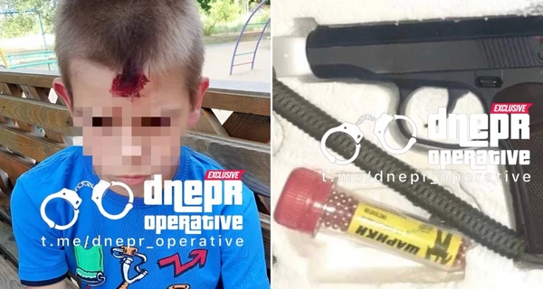 В Кривом Роге военный стрелял по детской площадке: ранен 10-летний мальчик 