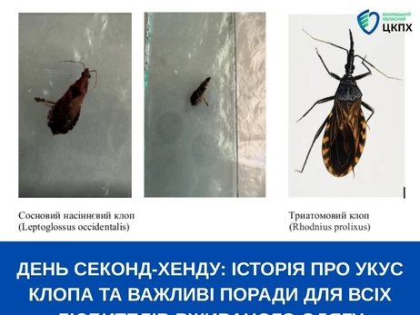 В Виннице женщину укусил клоп из Северной Америки, когда она примеряла штаны в секонд-хенде