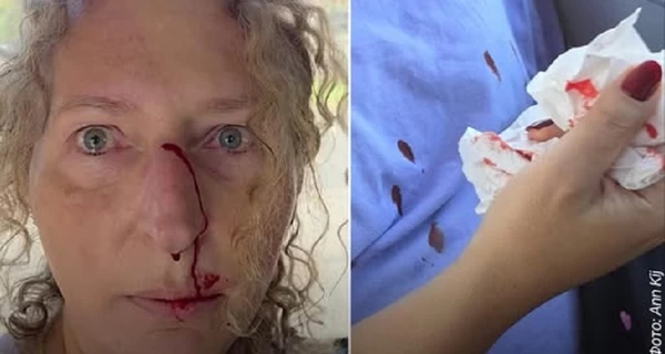 Посольство України у Польщі подякувало Зенобії Жачек: її голос став щитом від несправедливості 