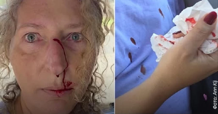 Посольство України у Польщі подякувало Зенобії Жачек: її голос став щитом від несправедливості 