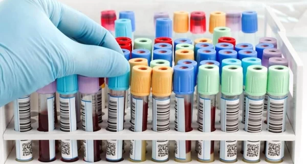 Через спалах гепатиту А на Закарпатті подекуди закрили ресторани і кафе та запровадили обмеження для туристів