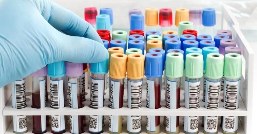 Из-за вспышки гепатита А на Закарпатье кое-где закрыли рестораны и кафе и ввели ограничения для туристов