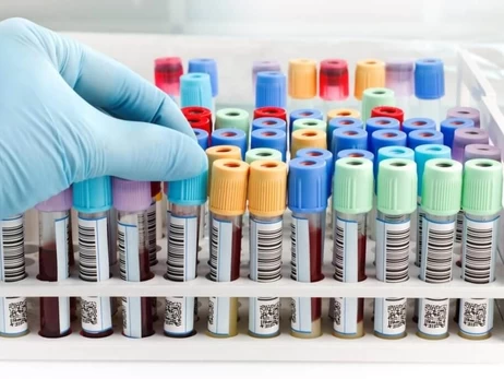 Через спалах гепатиту А на Закарпатті подекуди закрили ресторани і кафе та запровадили обмеження для туристів