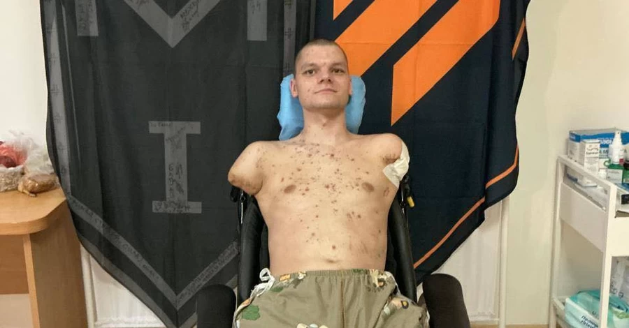 Приватбанк оплатить протезування ветерану, якому відмовили у оформленні картки