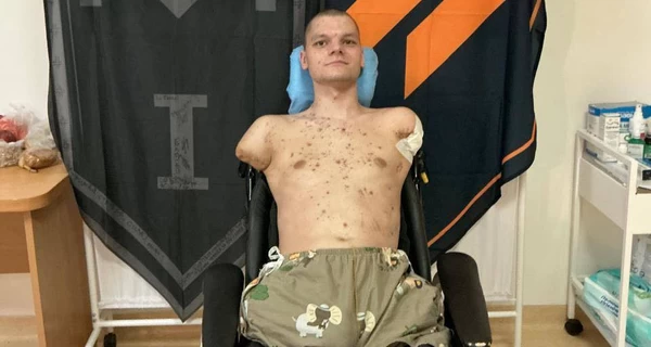 Ветерану отказали в переоформлении банковской карты, потому что у него нет рук: реакция 