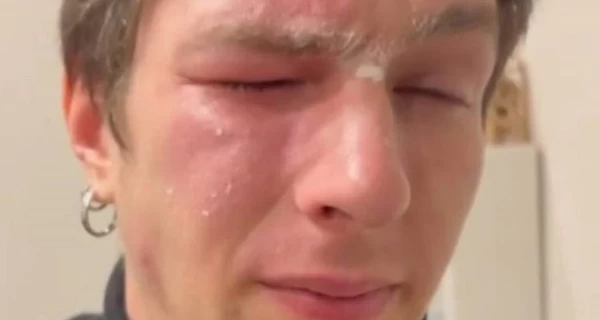 Во Львове из-за замечаний по мусору в подъезде облили перечным баллончиком ветерана войны