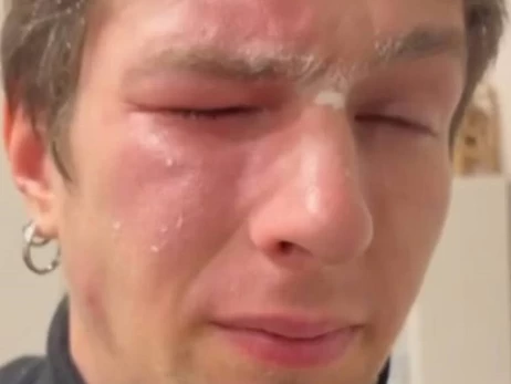 Во Львове из-за замечаний по мусору в подъезде облили перечным баллончиком ветерана войны