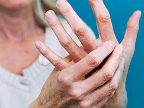 Почему болят суставы: ревматолог объяснила, когда это норма, а когда - тревожный сигнал