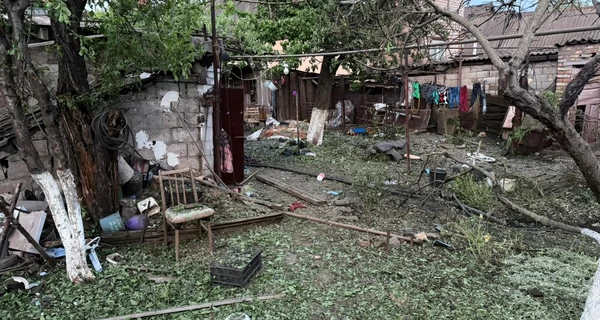 В Кривом Роге врачи смогли спасти ножку 9-месячной девочке 