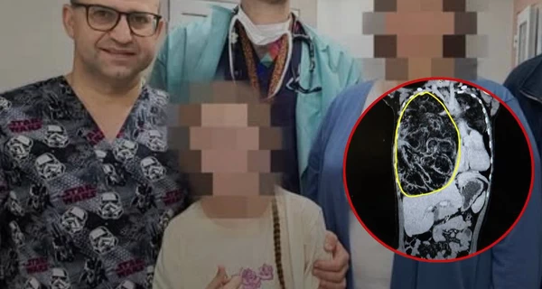 Во Львове медики удалили 4-килограммовую опухоль у 12-летней девочки