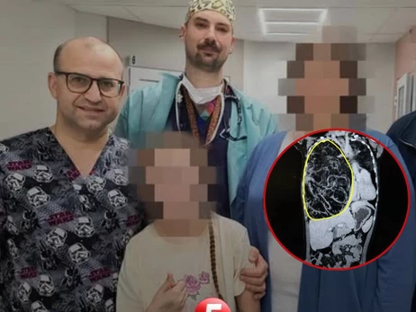 У Львові медики видалили 4-кілограмову пухлину у 12-річної дівчинки