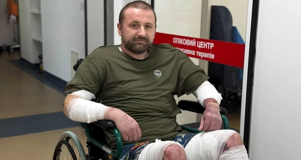 Во Львове двое мужчин получили 80% ожогов тела из-за взрыва бойлера
