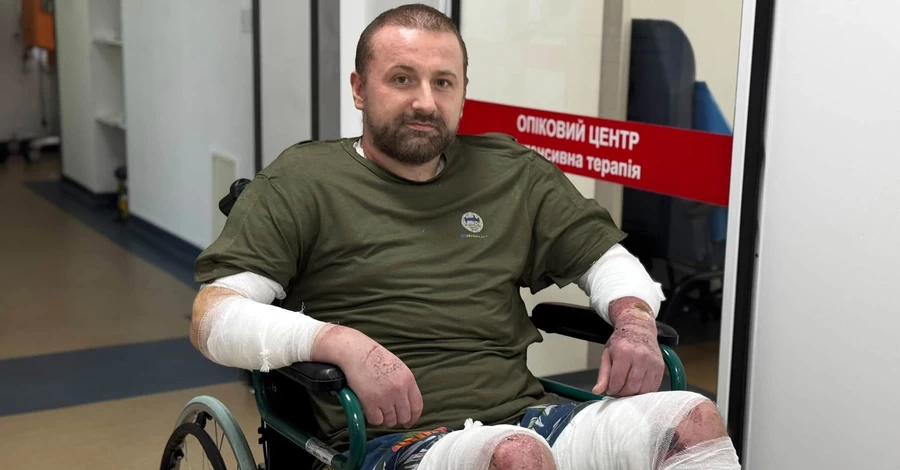 У Львові двоє чоловіків отримали 80% опіків тіла через вибух бойлера
