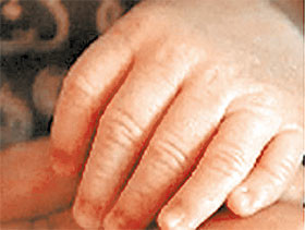 В Калифорнии родился мальчик с 24 пальцами  