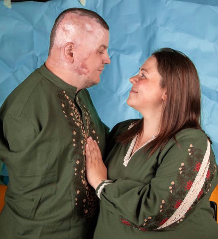 Навіть після важкого поранення Віталію Мізіну та його дружині Юлії вдалось відновити радощі кохання. Фото: instagram.com/juliya_mizina/​