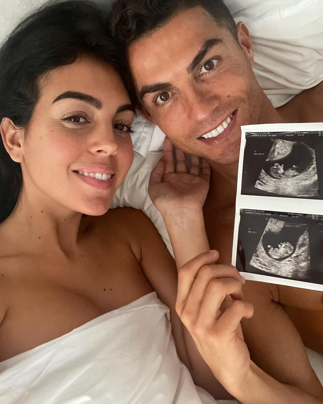 Роналду та Джорджина Родрігес чекають близнюків: футболіст показав УЗД фото 1