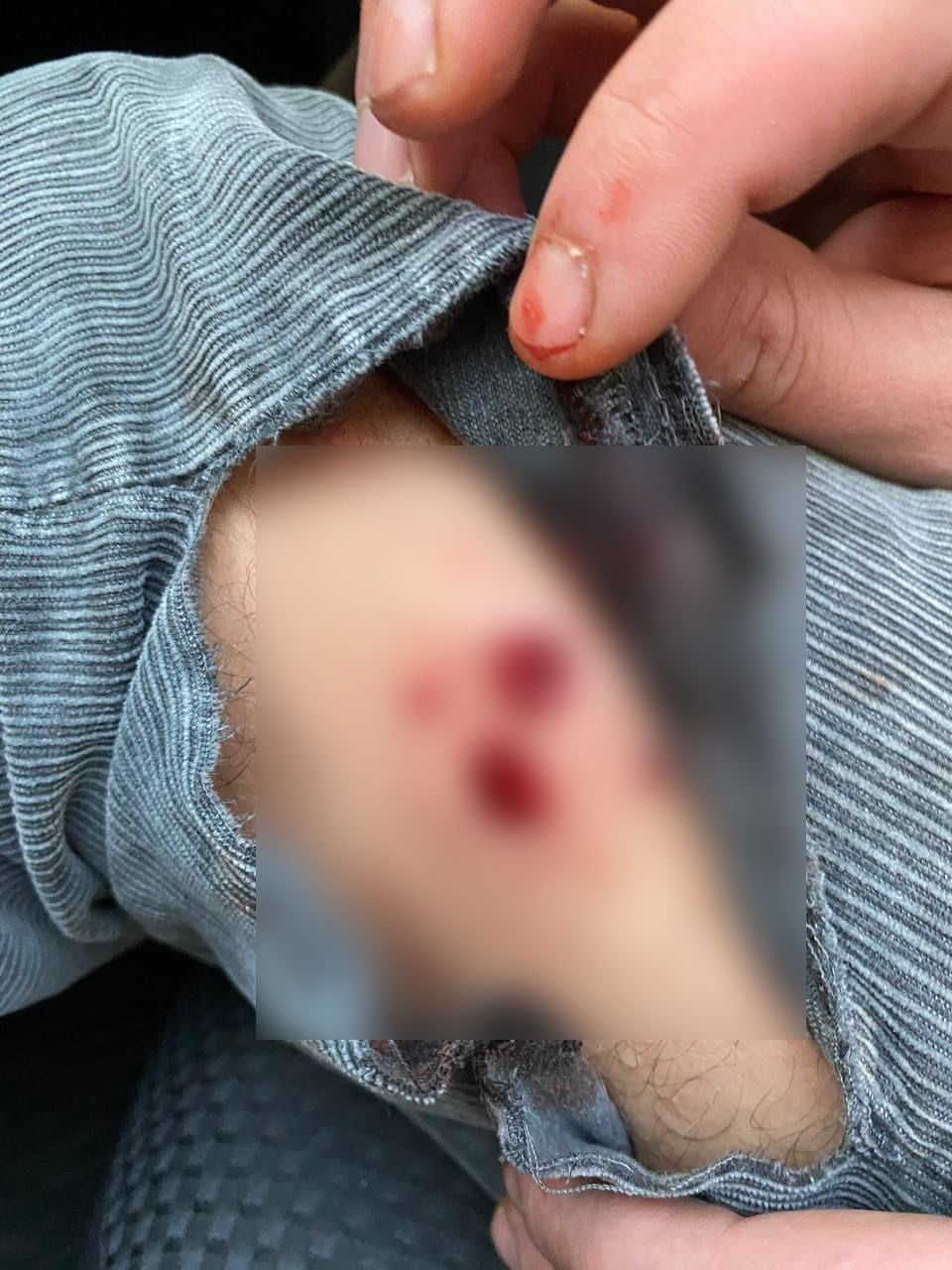 Мужчина, сидевший за рулем, получил ранение в ногу. FB\Полиция Киевской области.